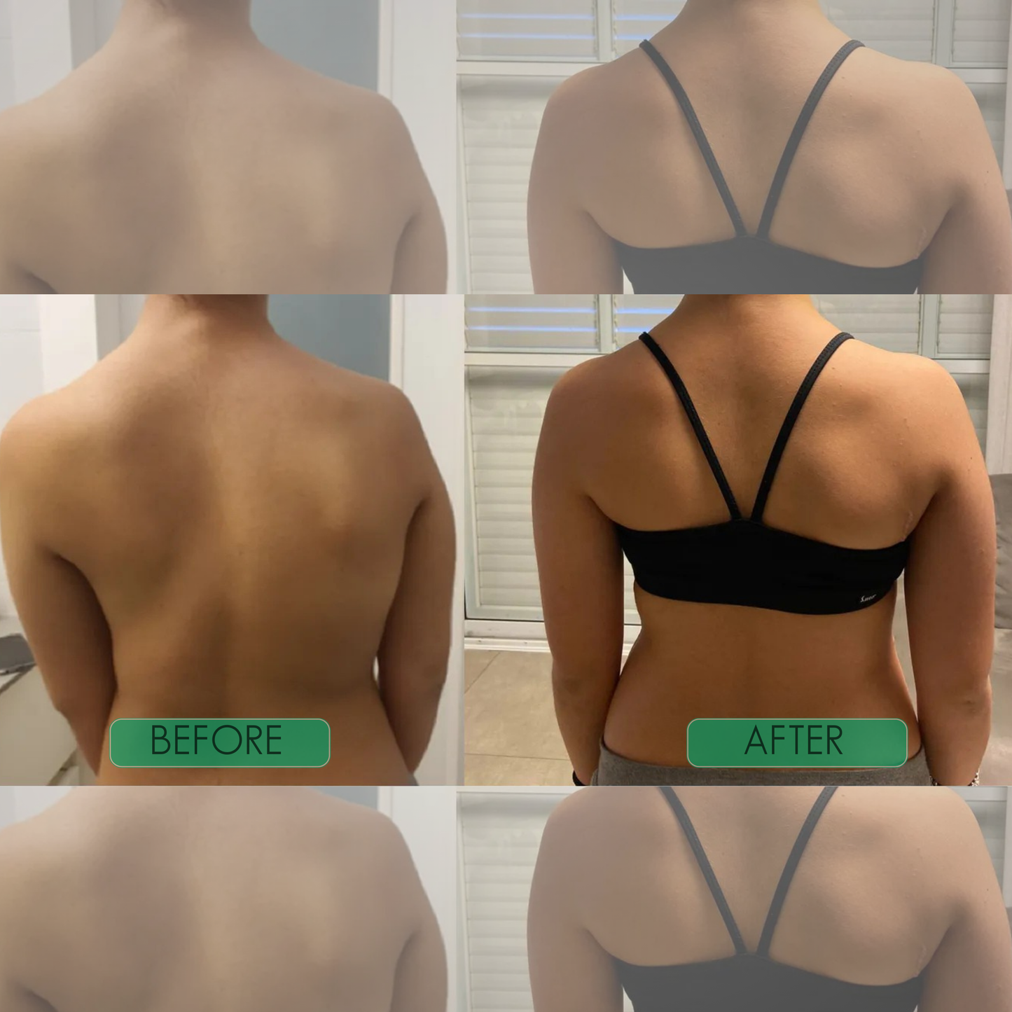 Correcteur de posture