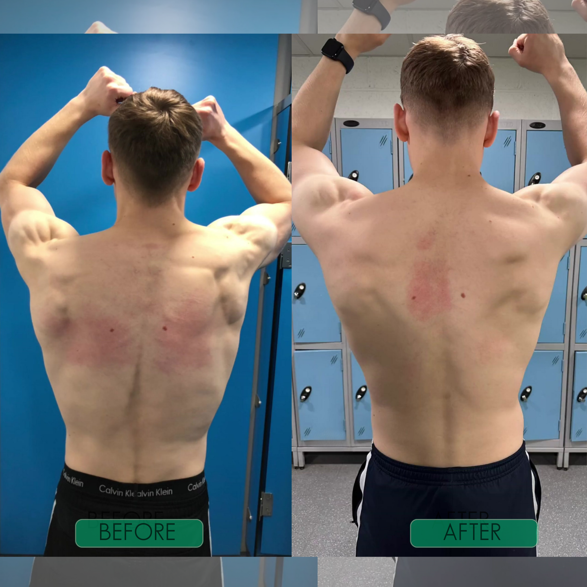 Correcteur de posture